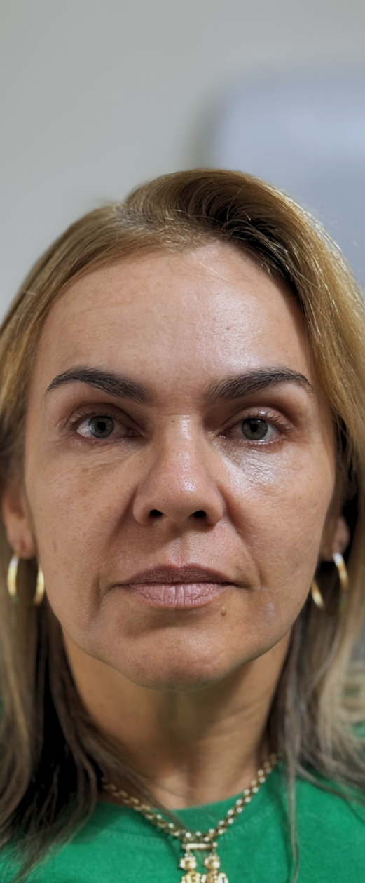 Imagem 14 — Depois