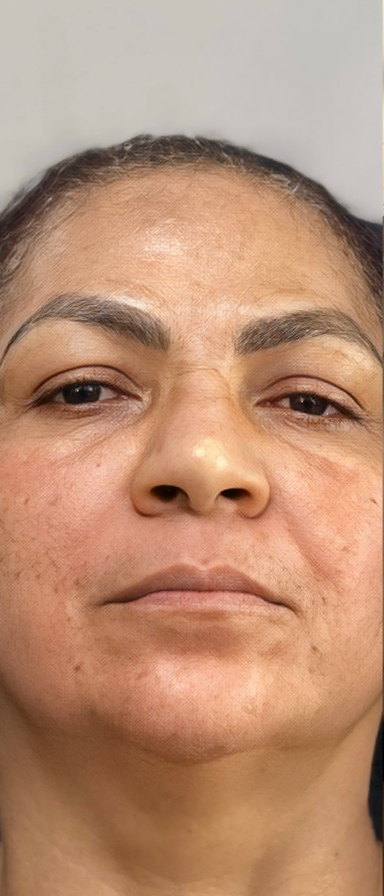 Imagem 5 — Antes