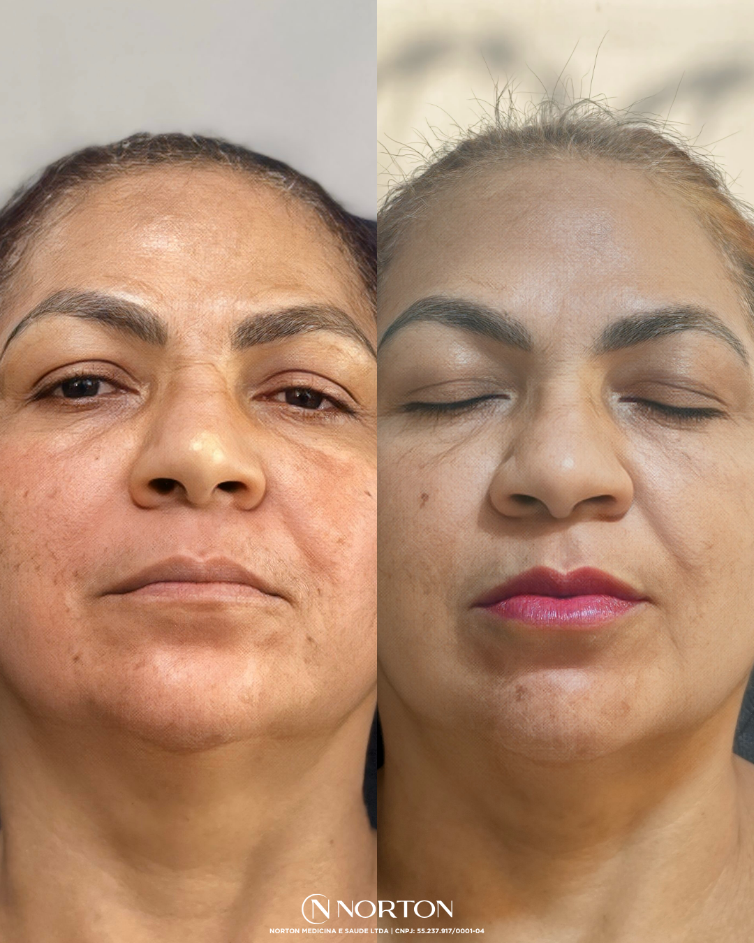 Feed Antes e Depois Divina.zip   1