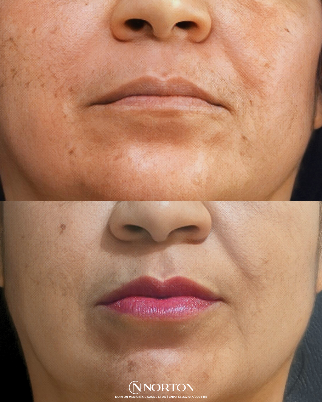 Feed Antes e Depois Divina.zip   2 (1)