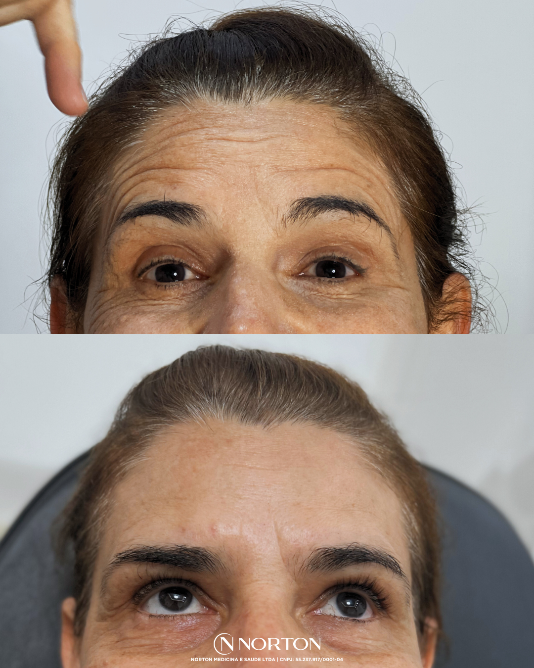 Feed Antes e Depois Glaucinete.zip   2