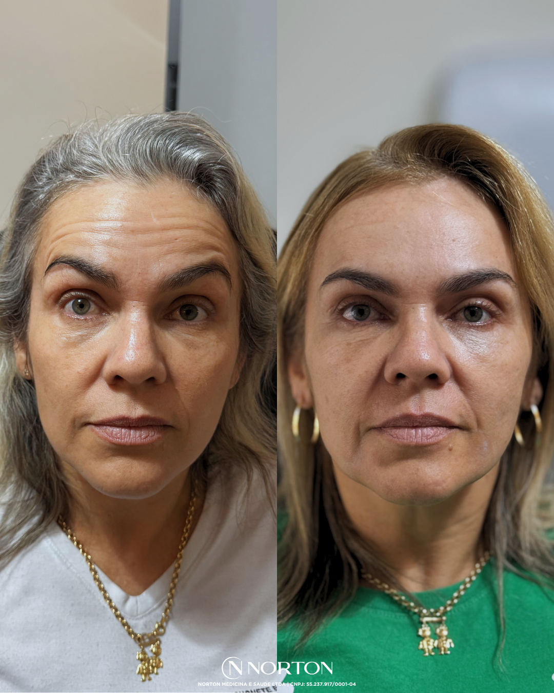 Feed Antes e Depois Luciana.zip   1 (1)