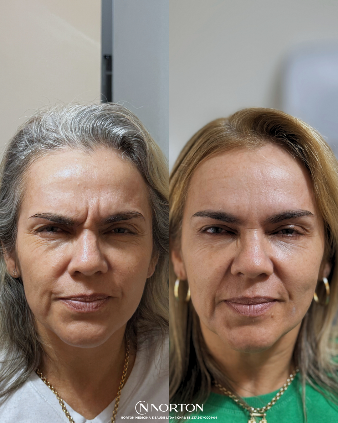 Feed Antes e Depois Luciana.zip   2 (1)